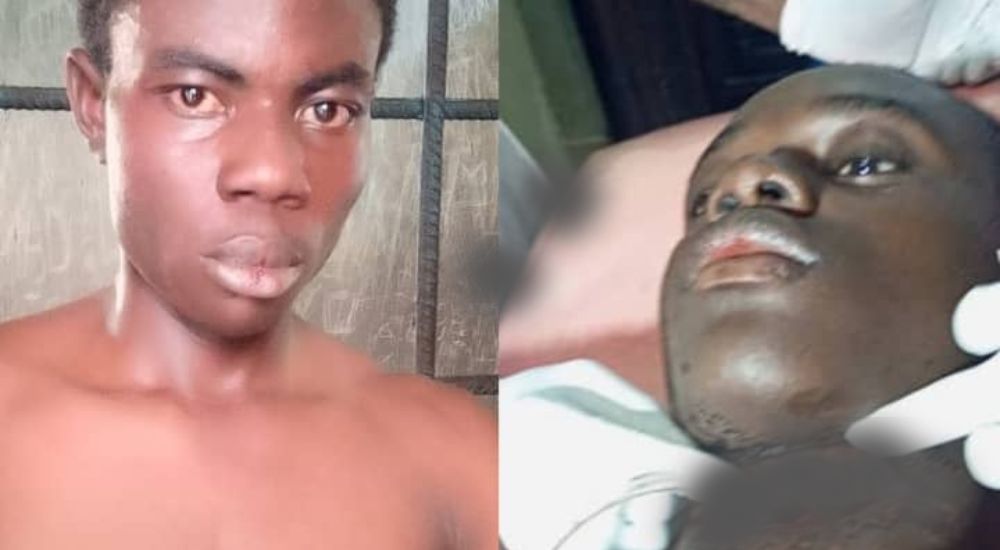 Man Slits Friend’s Throat In Kogi