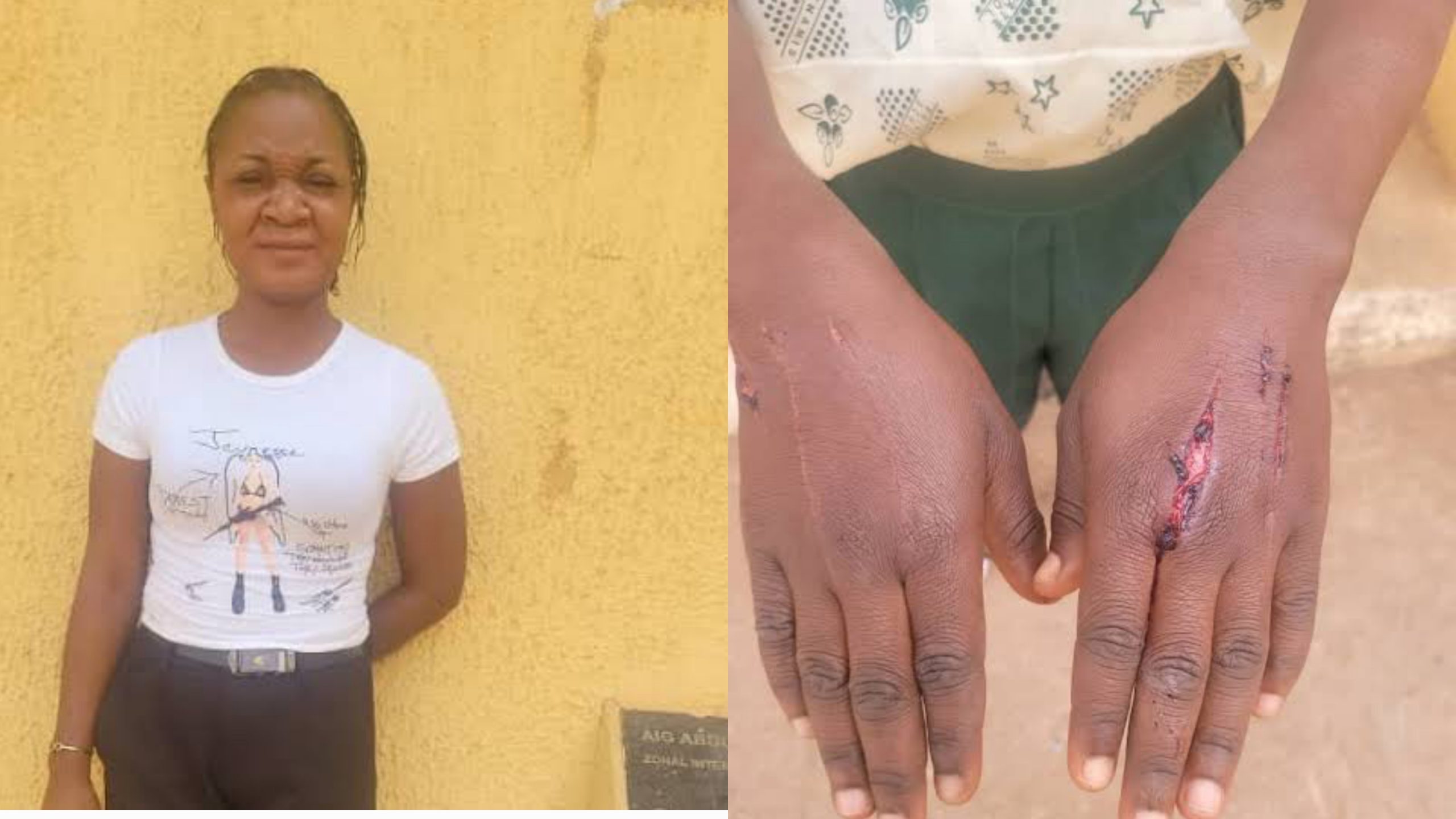 Ogun Police Arrest Guardian for Using Razor to Punish 10-Year-Old Boy