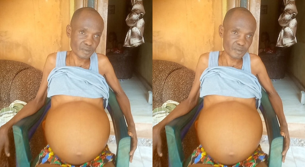 Enugu Business Man Seeks Help As He Battles Strange Sickness