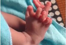 India baby born with 26 fingers and toes 4