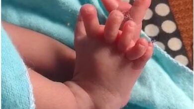 India baby born with 26 fingers and toes 4