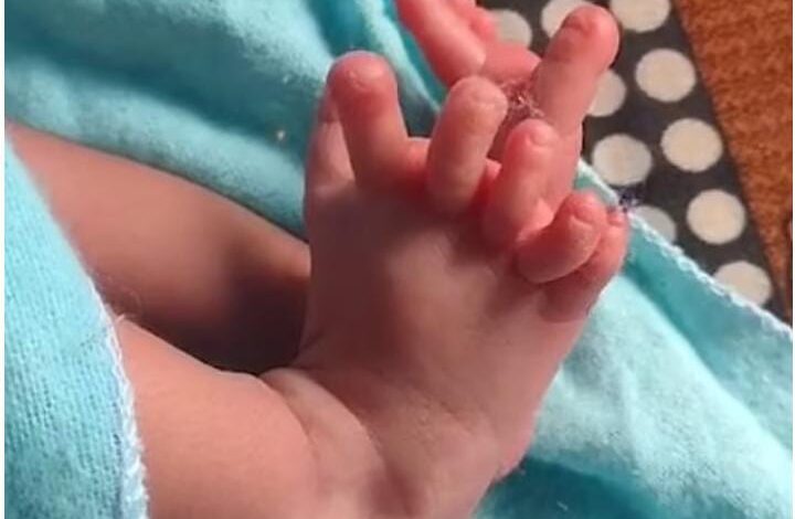 India baby born with 26 fingers and toes 4