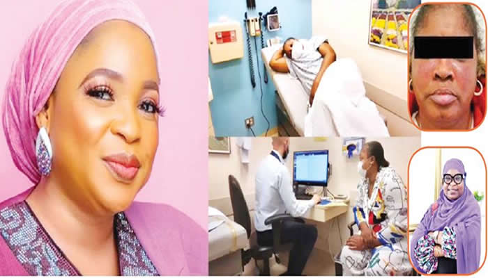 LUPUS PATIENTS