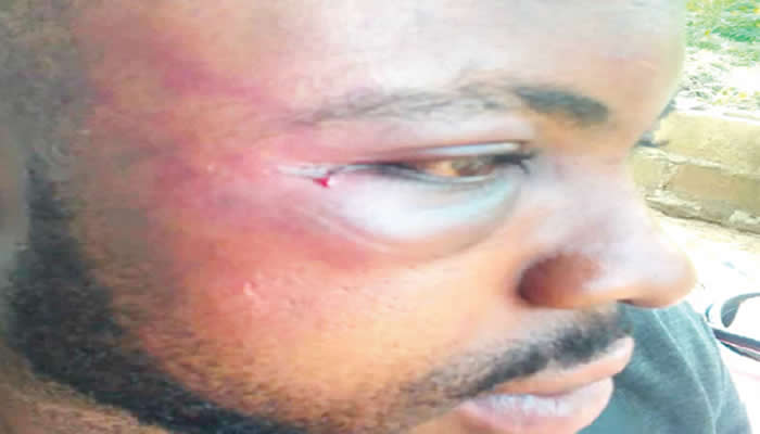One of the assaulted students